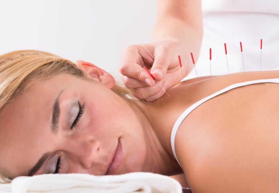 Akupunktúra pomôže zmierniť bolesť pri osteochondróze